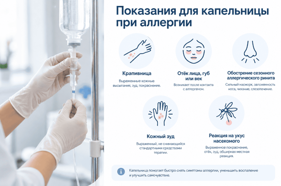 капельница при аллергии