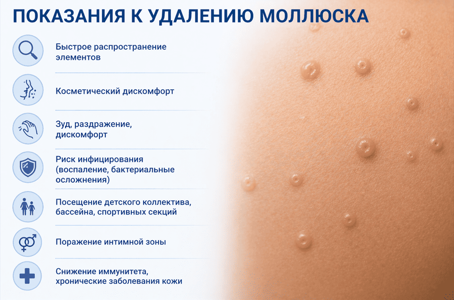 Показания и противопоказания к удалению
