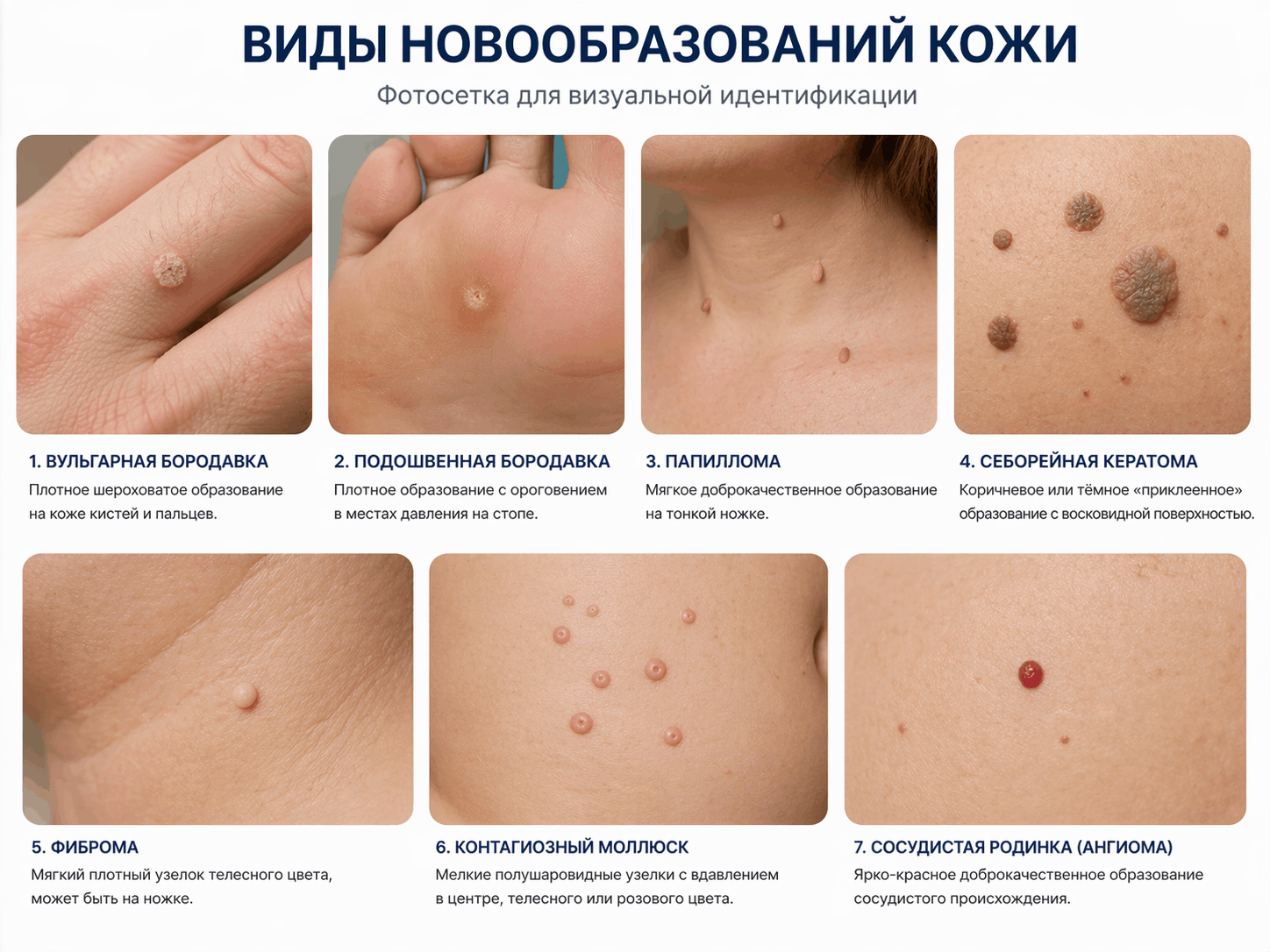 виды новообразований