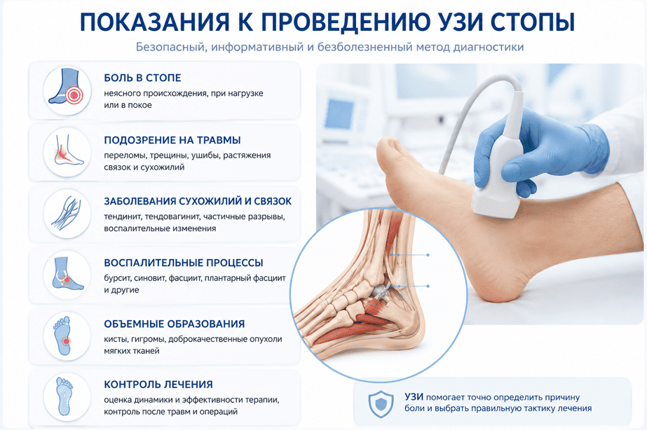 Показания к проведению УЗИ стопы
