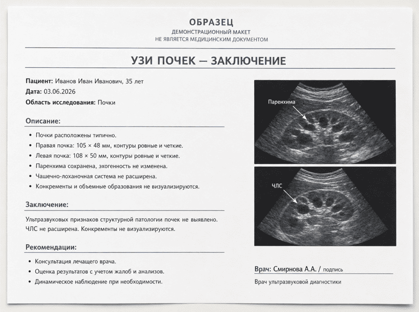Расшифровка результатов
узи почек