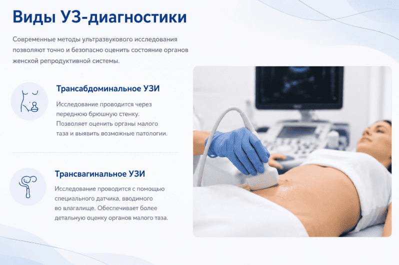 Виды УЗИ органов малого таза