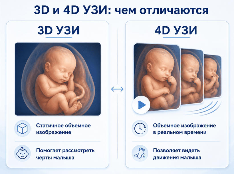 3D и 4D УЗИ: чем отличаются и когда есть смысл делать